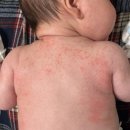 에버메디(주) 이미지