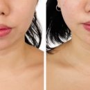 더해봄에스테틱 이미지