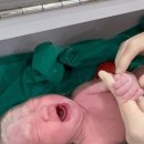 창원 라움산부인과 제왕절개 1일차 후기 • 2과 이수민 원장님 👩🏻‍⚕️ • 37w 5d 제왕 절개 👶🏻