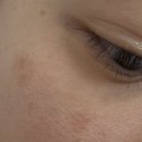 제약단지로 | 태극제약 도미나크림 내돈내산 후기(피부미백, 기미, 성분, 부작용)