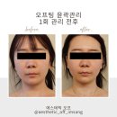 에스테틱오프