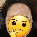 상동 피부과에서 수입산 스킨 부스터 받고 온 후기~!💉✨