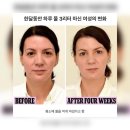 인셀덤4D러스터 쿠션 사용 후기