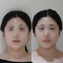 오직얼굴연구소 서초점 이미지