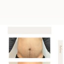 수파동테라피 이미지