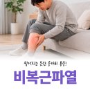 성모오케이정형외과의원 | 성모오케이정형외과, 갑자기 종아리가 찢어지는 듯 아프다면 꼭 확인하세요