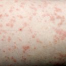 소잠한의원 이미지