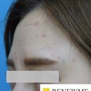 리뉴미피부과의원 이미지