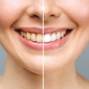 더연세퍼스트치과병원 이미지