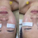 오로라 스킨테라피