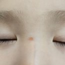 금강프라자 | 대전 노은 럭스피부과 미간 기름 화상 초진 / 손톱 염증 치료 후기 금강프라자 건물 주차장