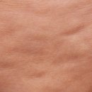 엘피메디칼 이미지