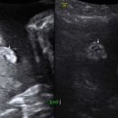 아름제일병원 이미지