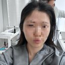 인프라뷰티 블랙점, 스칼프라인업케어 솔직후기