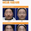 리프업의원 이미지