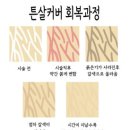 (주)태성메디칼 | 분당 튼살커버 주블링&amp;스킨52에서 엉덩이 튼살 커버업 후기