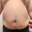 인천 지방분해주사 1회차 후기, 신랑 리즈시절 되찾기 프로젝트 시작!