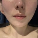 달리아에스테틱(신촌점) | 이대 에스테틱 추천 달리아에스테틱신촌점 후기