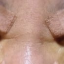 반듯한 멍이 이미지