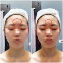 케이엠 전기(KM) | 불당동 피부관리 더케이엠 에스테틱 성형윤곽관리 후기