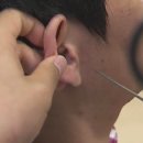 울림숲난청연구소 보청기 이미지