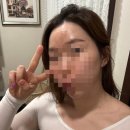 갤러리 | 인천 구월동 슬림바디관리 엔더몰로지 비타C스킨갤러리 후기