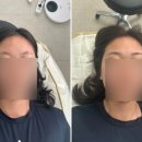 엘씨브로우