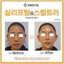 서울예쁨의원 이미지