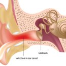 포낙보청기 마포센터 이미지