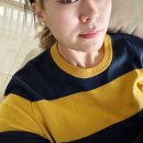 케이트의원 | [팔자주름 필러 후기] 케이트의원 필프팅후기, 팔자주름 안뇽~~