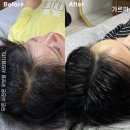 일러스라인 네이버블로그