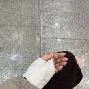 손목 골절 후기/홍천비발디파크 스키장 병원/골절 수술일기2