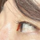 자이안경 위드렌즈 이미지