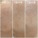 다올DETAIL | 라시뎀 미백 신제품 디멜라 화이트 앰플&크림 에스테틱 원장님 제품프로토콜과 임상후기❤