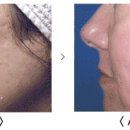 제니스피부과의원 이미지