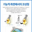 강남삼성성형외과