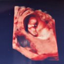 연세봄산부인과의원 | [임신일기.7] 임신7주-11주 / 입덧시작 / 내 생일 / 젤리곰보기 / 원주 연세봄산부인과 / 부모님 임밍아웃