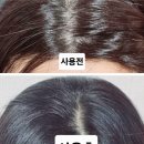 사사키 비듬샴푸 이걸로 종결! 여름 두피 고민까지 시원했던 핑크솔트 레드샴푸 후기