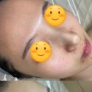 삼천포피부관리실바이엘 네이버블로그
