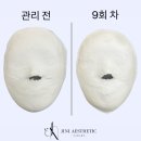 지니 에스테틱