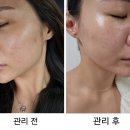 피부미애