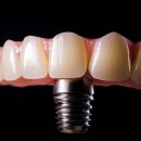 이스턴치과의원 이미지