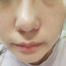 부위별 리프팅의 끝판왕! 듀얼소닉 이펙트 뷰티디바이스 솔직 후기