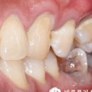 바른이웃치과의원 이미지