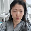 인프라뷰티 블랙점, 스칼프라인업케 솔직후기