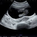 전한나산부인과의원 이미지