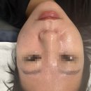 용인스타짐 | 용인 동백 모아모아 에스테틱 상세후기｜중요한 날 앞두고 받기 좋은 피부관리