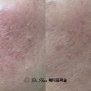 메디칼솔루션(Medical Solution) | [잠실피부레이저 후관리]시술 후가 진짜 시작이다: 박사 한지현 K뷰티케어센터의 '포스트 레이저 리커버리'