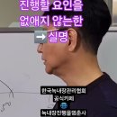 진행할 요인을 없애지 않는 한 실명할수 있다 이미지