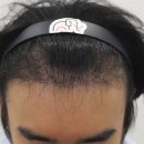 압구정맘모스헤어라인의원 이미지